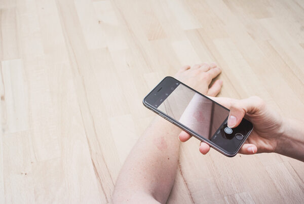 Eine Rötung auf einem Unterarm wird mit dem Handy fotografiert.